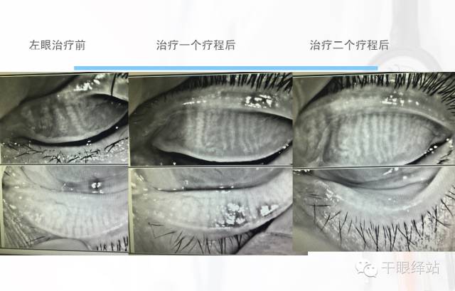 长沙爱尔眼科医院